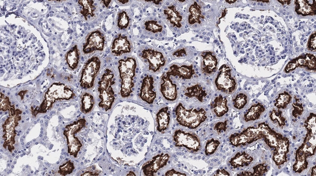 Bilden visar hur enzymet ACE2 (brunfärgat) uttrycks i njuren. Forskarna har kartlagt det celltypspecifika uttrycket av ACE2 i mer än 150 olika mänskliga celltyper.
